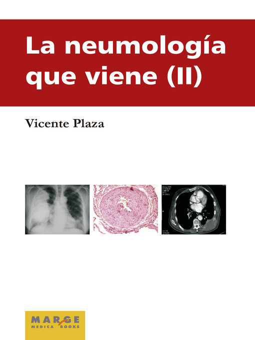 Title details for La neumología que viene, 2 by Vicente Plaza Moral - Wait list